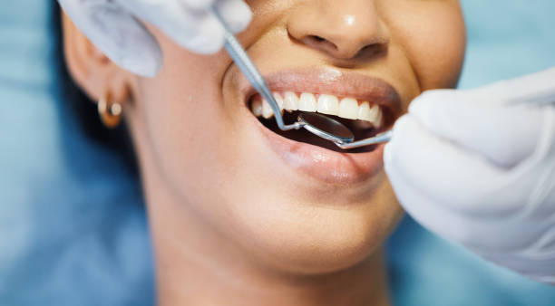 Best Chipped Tooth Repair Near Me  in Moa, UT