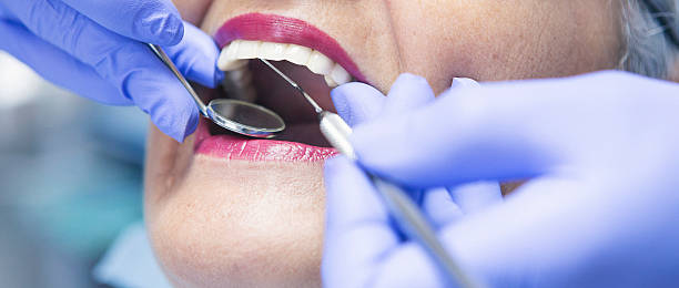 Best Chipped Tooth Repair Near Me  in Moa, UT